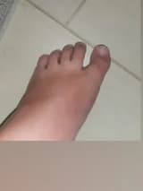 Stacy's ugly feet stacysuglyfeet OnlyFans