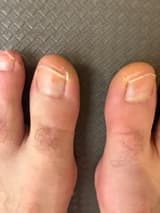 MyUglyFeetAUS myuglyfeetaus OnlyFans